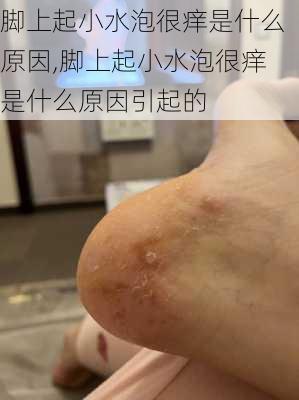 脚上起小水泡很痒是什么原因,脚上起小水泡很痒是什么原因引起的